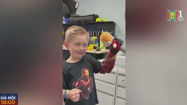 Cậu bé 5 tuổi được lắp cánh tay máy Iron Man 